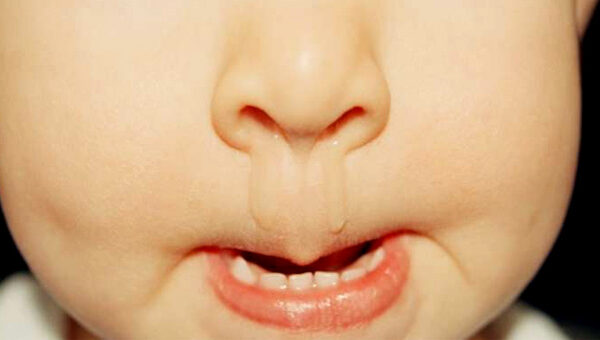 Nhìn dịch mũi đoán bệnh