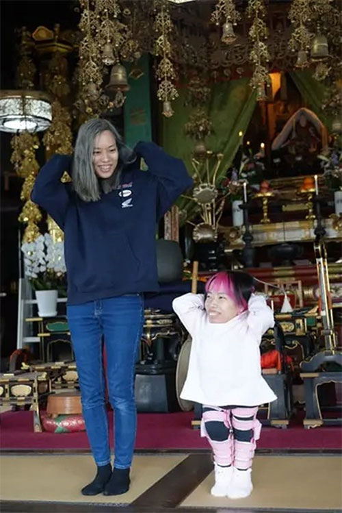 cap-sinh-doi-ky-la-2 Mặc dù Yoshie và Michie là song sinh nhưng có tính cách hoàn toàn trái ngược nhau.