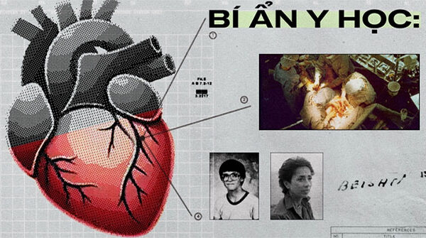 Bí ẩn y học: Trái tim được hiến tặng mách bảo chủ nhân mới tìm về nhà chủ nhân cũ, dù danh tính đã bị giấu kín