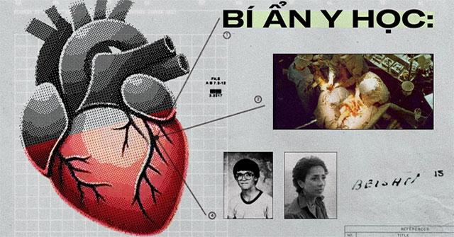 Bí ẩn y học: Trái tim được hiến tặng mách bảo chủ nhân mới tìm về nhà chủ nhân cũ, dù danh tính đã bị giấu kín