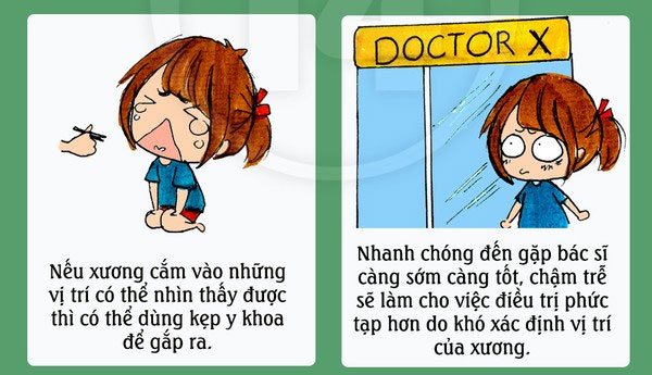 Khi bị hóc, cần nhanh chóng đến bác sĩ để gắp xương ra Cách xử lý "chuẩn không cần chỉnh" khi bị hóc xương cá